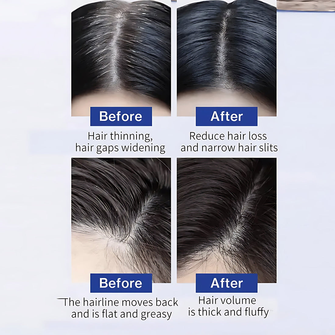 Hair Growth Spray Nourishing Scalp Treatment 50ml